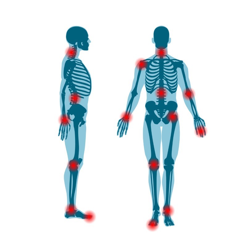 Rheumatology Rheumatology